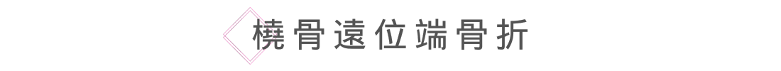 橈骨遠位端骨折