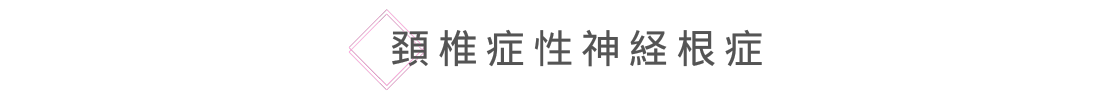 頚椎症性神経根症